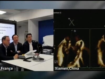 “Cuando un cirujano en Francia salva un corazón en China: el negocio global que acaba de despertar”