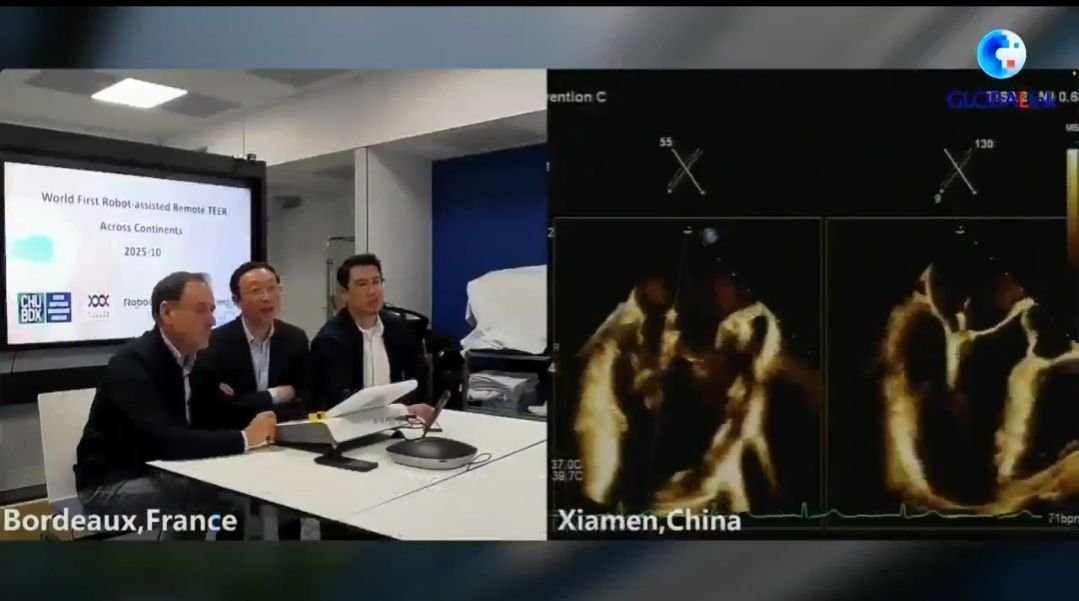 “Cuando un cirujano en Francia salva un corazón en China: el negocio global que acaba de despertar”