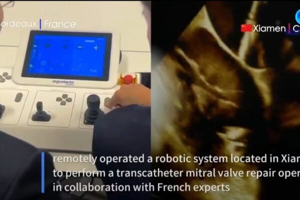 “Cuando un cirujano en Francia salva un corazón en China: el negocio global que acaba de despertar”