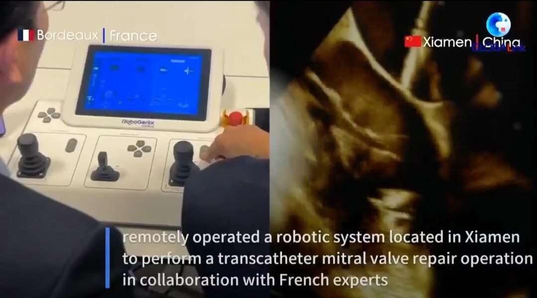 “Cuando un cirujano en Francia salva un corazón en China: el negocio global que acaba de despertar”
